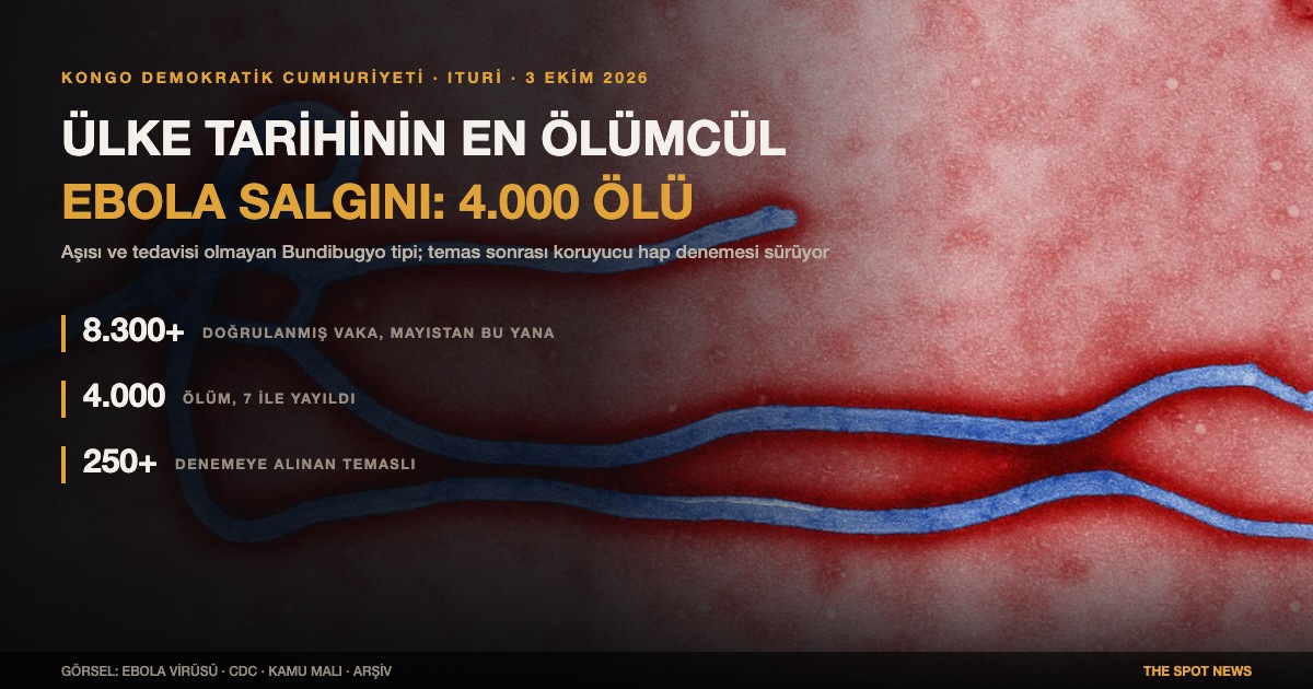 Ebola virüsü, renklendirilmiş elektron mikrografı