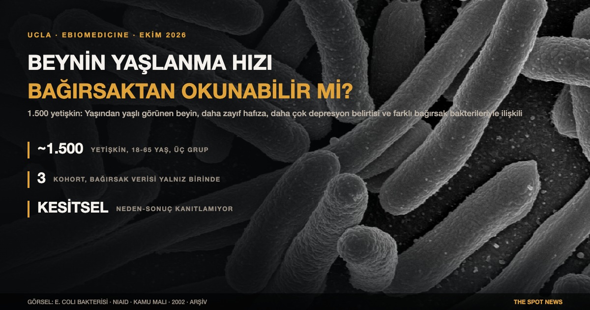E. coli bakterileri, renklendirilmiş elektron mikrografı